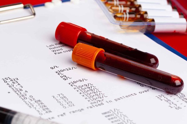 comprendre les symptômes du cancer du sein